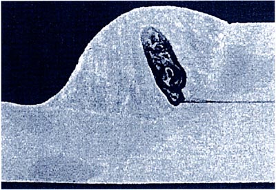 写真1 亜鉛めっき鋼板でのブローホール発生例